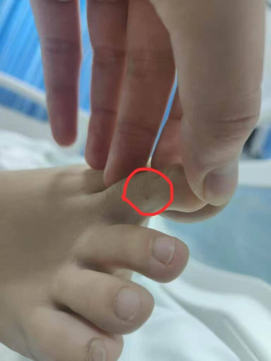 三亚死亡女子家属回应质疑：第二家医院使用了血清抢救，愿意尸检配合调查